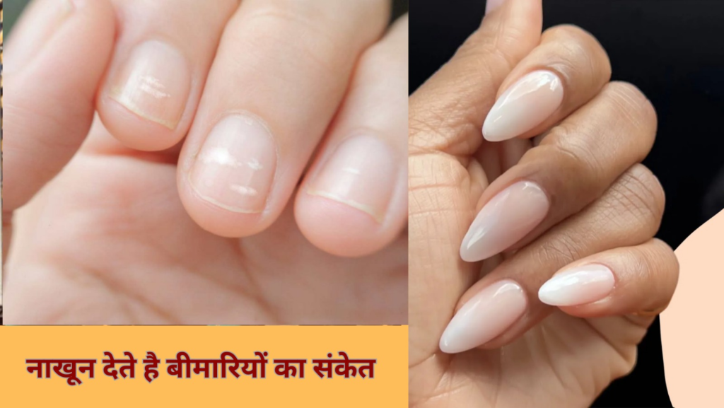Tips to keep your nails healthy and strong